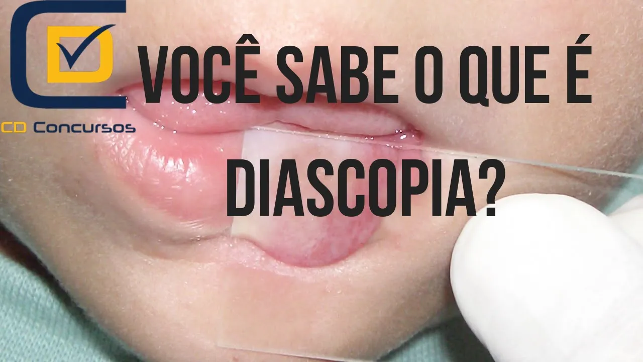 Você sabe o que é diascopia?