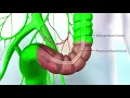 3D Animation Visualization of a Colectomy using ICG
