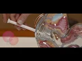 BoriCap Boric Acid Suppository Applicator Tutorial