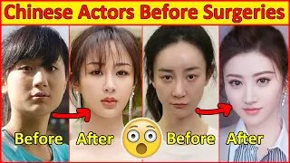 chinese actors before and after plastic surgeries incredible changes chinese drama