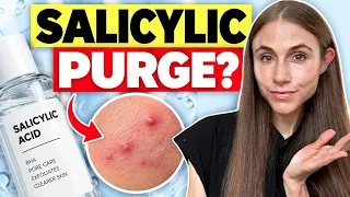 Does Salicylic Acid Cause Purging? Dermatologist Q&A