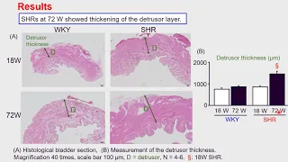 Aging causes polyuria and bladder overdistension in spontaneously hypertensive rats