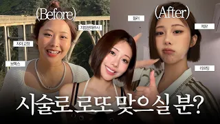 [광고❌] 달씨가 받았던 시술 총정리 | 울쎄라로 대박날 얼굴 특징 알려드림