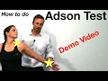 Download Lagu How to do the Adson Thoracic Outlet Test