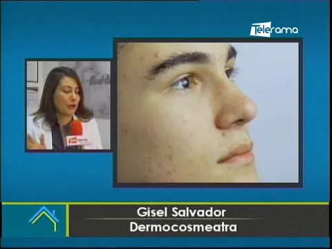 Acné corporal ¿Por qué se produce y como combatirlo?