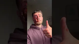 رسمت على وجهي جرح وفاجأت الناس 