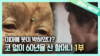 코가 함몰된 할머니 미간에 못이 박혀있는 이유는 The Reason Why She Has A Nail In Her Forehead 