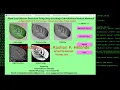 Plant Disease Detection Using Deep Learning CNN Python Code Leaf Disease Classification