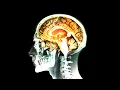 A Woman Drank 35 Food Grade Hydrogen Peroxide This Is What Happened To Her Brain