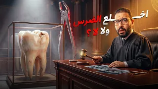 متى يكون خلع الضرس هو الحل الأخير؟ | Smile Expertez Clinics