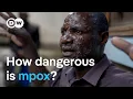 Download Lagu New mpox virus: Why is it spreading so quickly? | DW News