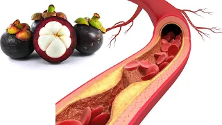 Mangosteen Tea || Best Medicinal Tea || Healthy Tea ||Mangosteen Nutrition facts || Recipe No : 18. 