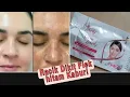 Download Lagu SEBAGUS ITU HASILNYA ‼️FLEK HITAM TERKIKIS \u0026WAJAH DEKIL JADI PUTIH GLOWING.