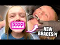 Download Lagu Kalia Gets Braces For The First Time! *SCARY*