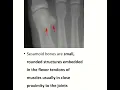 Sesamoid Bone Anatomy Understanding the Tiny Bones That Pack a Big Punch