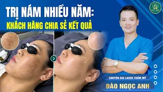 TRỊ NÁM NHIỀU NĂM: Khách Hàng Hoa Anh Chia Sẻ Kết Quả| Đào Ngọc Anh { Thẩm Mỹ }