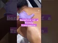 Massage After A BBL