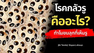 โรคกลัวรูคืออะไร และเกิดจากสาเหตุใด