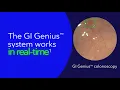 GI Genius in 30 Seconds Enhanced Detection with AI