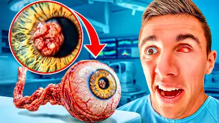 I Found Something WRONG with my REAL Eye...