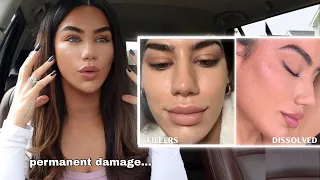 permeant damage by fillers what no one told me 