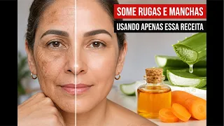 Melasma E Rugas use essa dica caseira sem gasta faz milagres