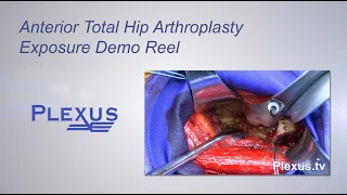 anterior total hip arthroplasty exposure surgery video