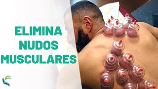 Muscle CONTRACTURE 😥 treatment with VENTOSES or CUPPING 🔔 Fisiolution
