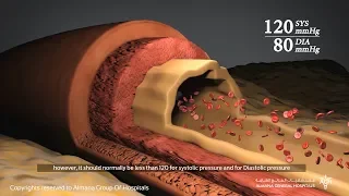 ما هو ضغط الدم  و متى يكون مرتفعا  دندنها
