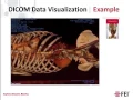 Webinar Open Inventor Introduction for Medical Software Applications Development