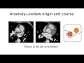 Describing coronary artery anomalies