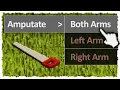 Cutting off both of my arms for the pain convention