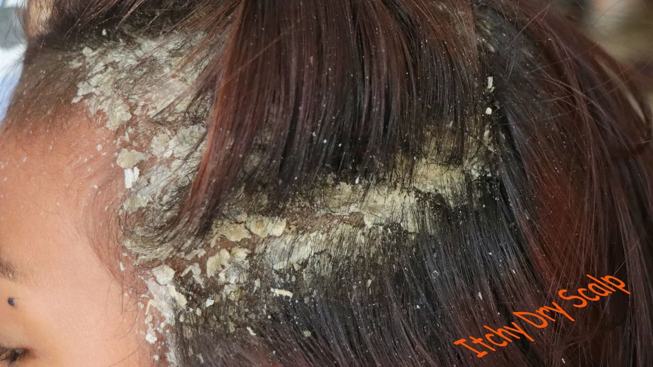 Dark To Light Hair For Summer | L'Oreal Feria | Blue Shampoo