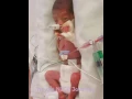 Download Lagu Nova's NICU Journey