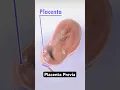 How placenta can block your baby s birth 3D Animation