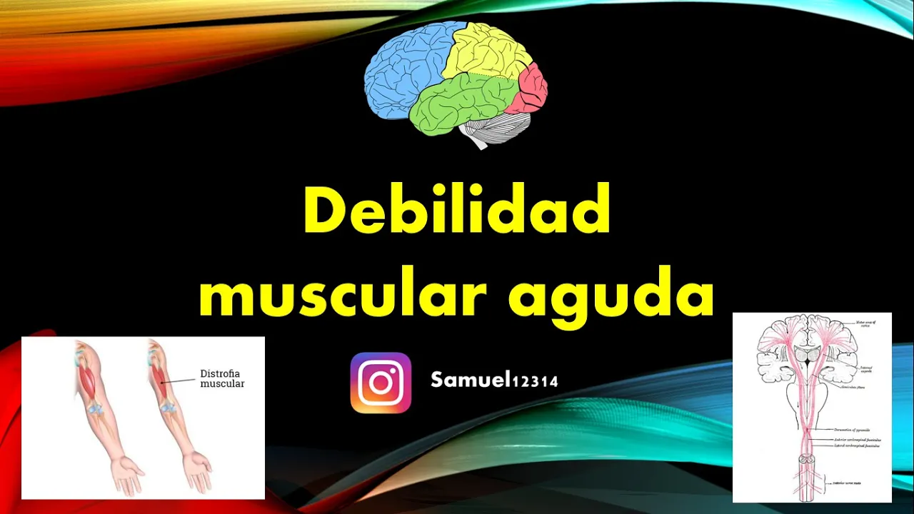 🧠 ABORDAJE DIAGNOSTICO de la DEBILIDAD MUSCULAR AGUDA ✅ - FISIOPATOLIA Y ETIOLOGIAS