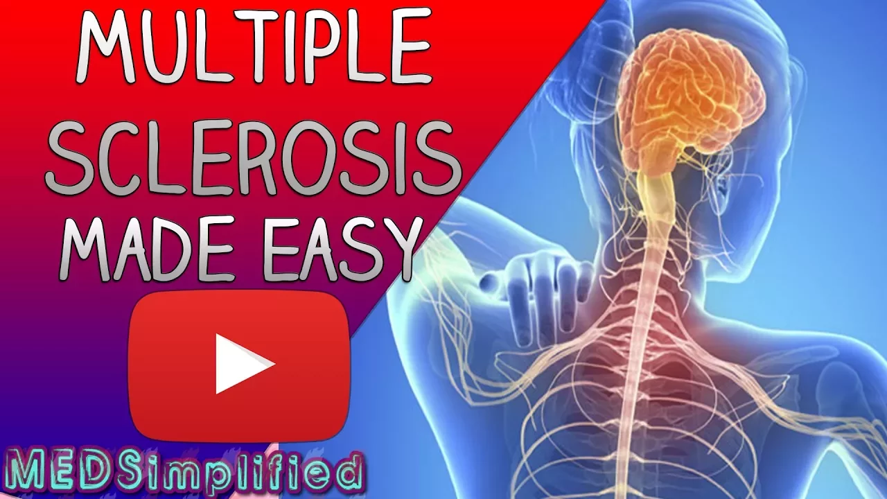 Multiple Sclerosis Made Easy- Pathophysiology,symptoms,Treatment.