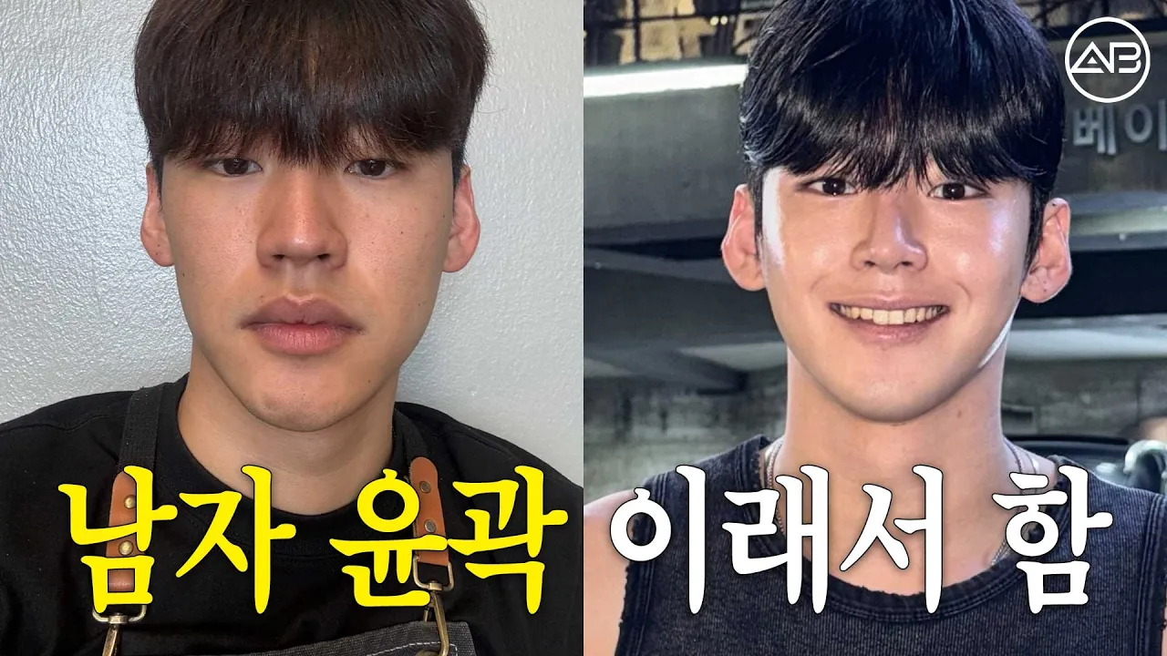 남자 눈·코·윤곽 수술 1년 후… 주변 반응이 폭발했습니다🤣 | 남자 성형 후기 | 에이비성형외과