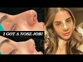 I GOT A NOSE JOB IN TURKEY WITH THE BEST SURGEON - PART 1 CLINICHUB