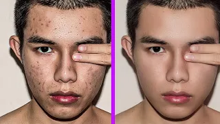 Fastest way to clean your face in photoshop Remove pimples blemishes acne easily