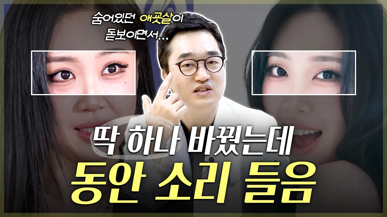 눈밑지애교살살리기, 왜 어려 보일까? 애교살·중안부·앞볼이 달라지는 이유ㅣ20대눈밑지방볼록