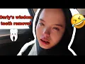 Wisdom Teeth Removal SO LOL