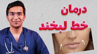 بهترین روش های درمان خط خنده 