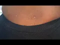 Back Dermal Piercings