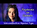 I'm in Psychosis. | Psychotic Episode Caught on Camera