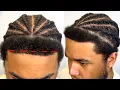 there s nothing wrong with his hairline i m just over exaggerating