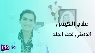 علاج الكيس الدهني تحت الجلد 