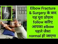 elbow fracture surgery physiotherapy exercises - complete rehabilitation program