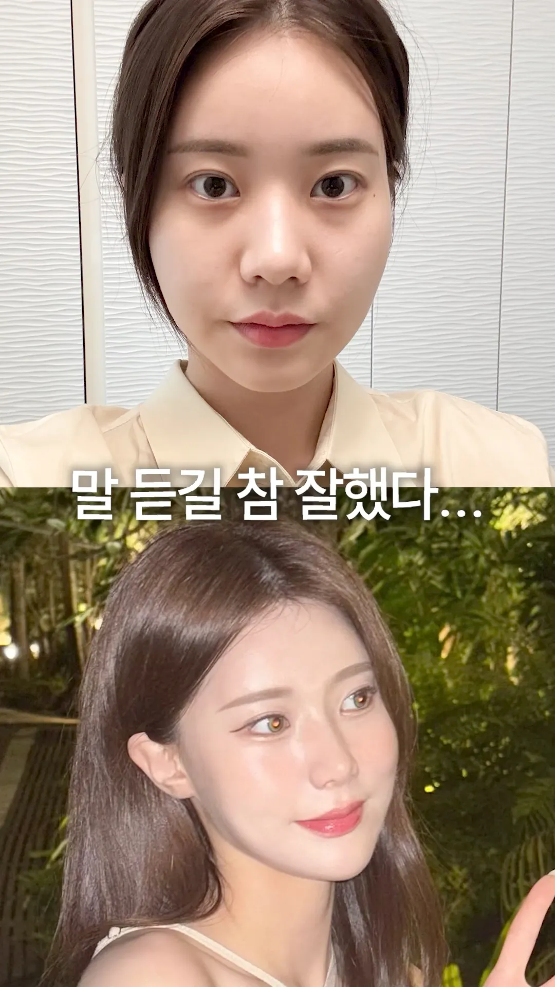 피부시술 뭐할지 모르겠다면 이 3가지만 기억하세요!