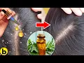 9 Health Benefits Of Tea Tree Oil That Can Help Your Skin Acne Dandruff